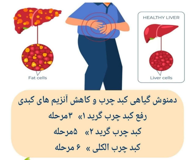 داروی کبد چرب گرید 1، گرید 2 و گرید 3، بدون عوارض